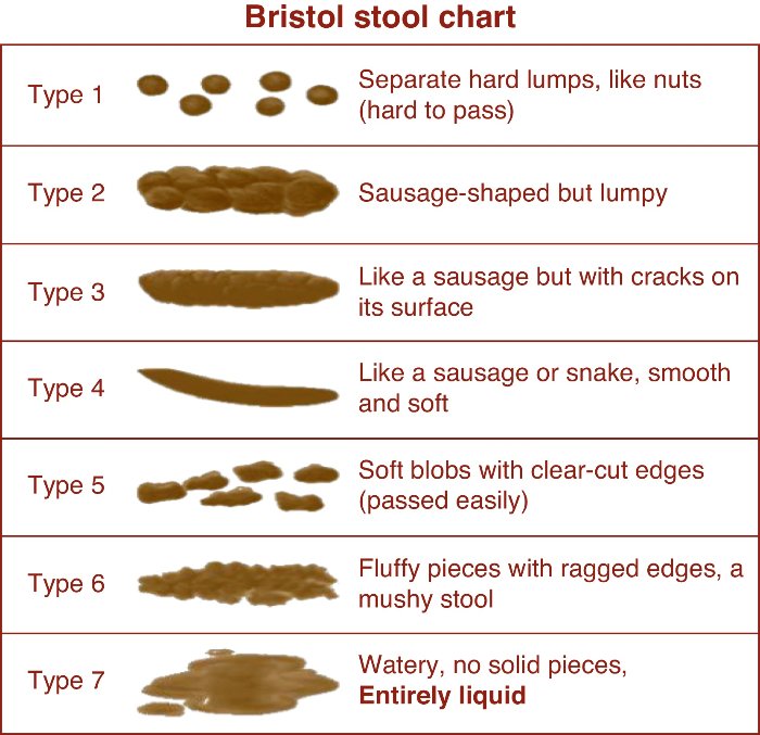 stool-chart- what does your poop look like - Beating Pancreatitis